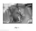 Fig. 04 - METHOD FOR PREVENTING OR TREATING HEART FAILURE
