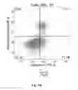 Fig. 13 - METHOD FOR PREVENTING OR TREATING HEART FAILURE