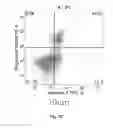 Fig. 14 - METHOD FOR PREVENTING OR TREATING HEART FAILURE