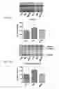Fig. 03 - MITOCHONDRIAL-TARGETED ANTIOXIDANTS PROTECT AGAINST MECHANICAL VENTILATION-INDUCED DIAPHRAGM DYSFUNCTION AND SKELETAL MUSCLE ATROPHY
