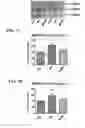 Fig. 10 - MITOCHONDRIAL-TARGETED ANTIOXIDANTS PROTECT AGAINST MECHANICAL VENTILATION-INDUCED DIAPHRAGM DYSFUNCTION AND SKELETAL MUSCLE ATROPHY