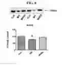 Fig. 11 - MITOCHONDRIAL-TARGETED ANTIOXIDANTS PROTECT AGAINST MECHANICAL VENTILATION-INDUCED DIAPHRAGM DYSFUNCTION AND SKELETAL MUSCLE ATROPHY