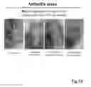 Fig. 20 - Composition having tissue-repairing activity, and use therefor