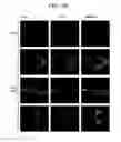 Fig. 10 - METHODS AND COMPOSITIONS FOR TREATMENT OF MITOCHONDRIAL DISORDERS