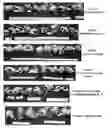 Fig. 01 - Use of recombinant human calcineurin B subunit