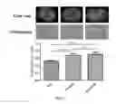 Fig. 02 - Methods and compositions for treating metabolic imbalance in neurodegenerative disease