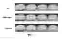 Fig. 03 - Methods and compositions for treating metabolic imbalance in neurodegenerative disease