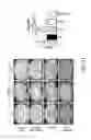 Fig. 30 - Methods and compositions for treating metabolic imbalance in neurodegenerative disease