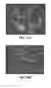 Fig. 47 - Methods and compositions for treating metabolic imbalance in neurodegenerative disease