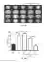 Fig. 54 - Methods and compositions for treating metabolic imbalance in neurodegenerative disease