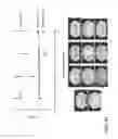 Fig. 64 - Methods and compositions for treating metabolic imbalance in neurodegenerative disease