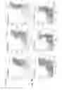 Fig. 11 - PROGNOSIS AND TREATMENT OF SQUAMOUS CELL CARCINOMAS