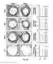 Fig. 08 - A METHOD OF INHIBITING EXACERBATIONS OF T CELL-MEDIATED ALLOGRAFT VASCULOPATHY