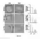 Fig. 14 - A METHOD OF INHIBITING EXACERBATIONS OF T CELL-MEDIATED ALLOGRAFT VASCULOPATHY