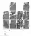 Fig. 08 - Prostate-targeting adeno-associated virus serotype vectors