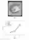Fig. 03 - Wound dressing material comprising fibrillated accellular dermis matrix and biodegradeable polymer, and preparation method therefor