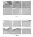 Fig. 05 - Wound dressing material comprising fibrillated accellular dermis matrix and biodegradeable polymer, and preparation method therefor