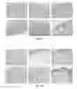 Fig. 06 - Wound dressing material comprising fibrillated accellular dermis matrix and biodegradeable polymer, and preparation method therefor