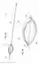 Fig. 08 - Stiff guide wire with anchoring configuration