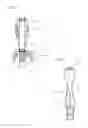 Fig. 07 - Trans-anal inflow catheter for intermittently triggering a reflex-coordinated defecation