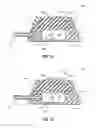 Fig. 09 - Assemblies for identifying a power injectable access port