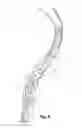 Fig. 09 - Lacrosse head