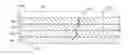 Fig. 01 - Repair patch for composite structure and associated method