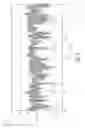 Fig. 07 - Vibration sensor