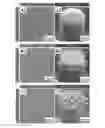 Fig. 01 - Systems and methods for particulate removal using polymeric microstructures