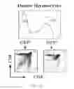 Fig. 32 - Agents and methods to elicit anti-tumor immune response