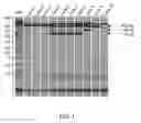 Fig. 02 - METHOD FOR ANALYZING A SAMPLE TO DETECT THE PRESENCE OF SULPHITE-RESISTANT YEASTS OF THE BRETTANOMYCES BRUXELLENSIS SPECIES AND KIT FOR IMPLEMENTING SAME