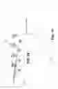 Fig. 03 - Atomic layer clean for removal of photoresist patterning scum