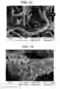 Fig. 10 - Highly functional spunbonded fabric made from particle-containing fibres and method for producing same
