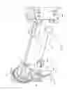 Fig. 22 - Center drop shade mount