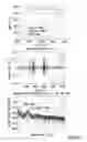 Fig. 06 - Automated spiraling detection