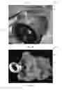 Fig. 04 - Drilling mud screen system and methods thereof