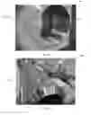 Fig. 05 - Drilling mud screen system and methods thereof