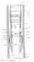Fig. 01 - Multi-segmented plug