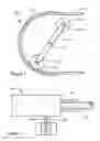 Fig. 02 - Peristaltic pump with controlled stop