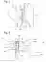 Fig. 03 - Swivel stack