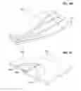 Fig. 16 - Étendue-squeezing light injector and apparatus