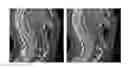 Fig. 01 - Systems and methods for detecting landmark pairs in images