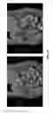 Fig. 22 - Systems and methods for detecting landmark pairs in images