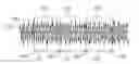 Fig. 01 - Audio coder window sizes and time-frequency transformations