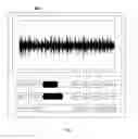 Fig. 08 - Loudness Assistance System
