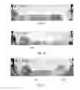 Fig. 04 - Structure and method for enhancing robustness of ESD device