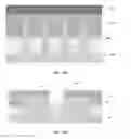 Fig. 11 - Method for manufacturing semiconductor device that comprises a fin structure