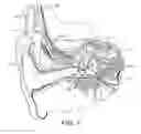 Fig. 02 - Binaural cochlear implant processing