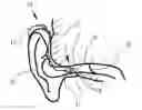 Fig. 01 - Earpiece for coupling a hearing aid to a users's ear canal and a method for manufacturing such an earpiece