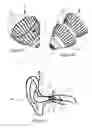 Fig. 04 - Earpiece for coupling a hearing aid to a users's ear canal and a method for manufacturing such an earpiece